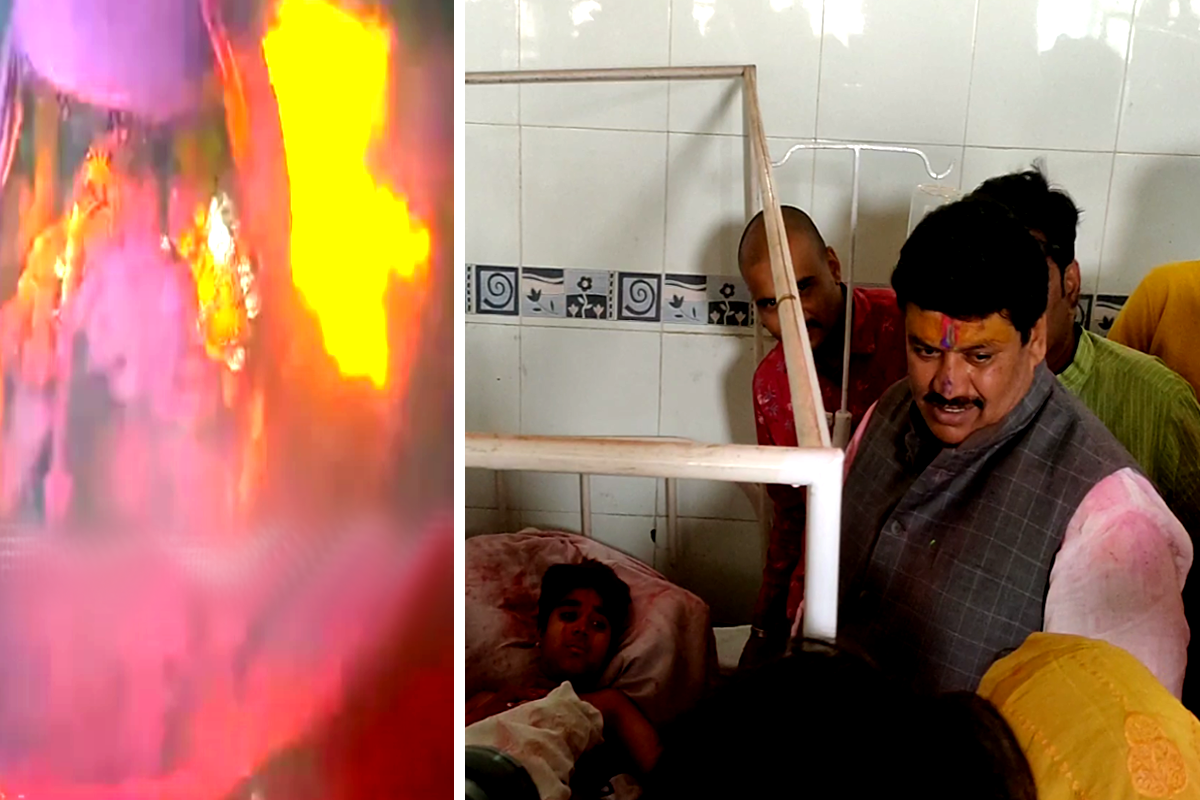 महाकाल मंदिर में आग से झुलसे पुजारी सेवकों समेत 16 लोगों की अब ऐसी हालत है, देखने पहुंचे सांसद, VIDEO