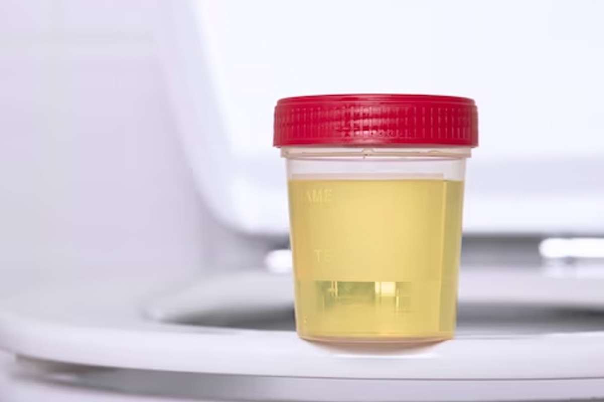 cloudy-urine.jpg