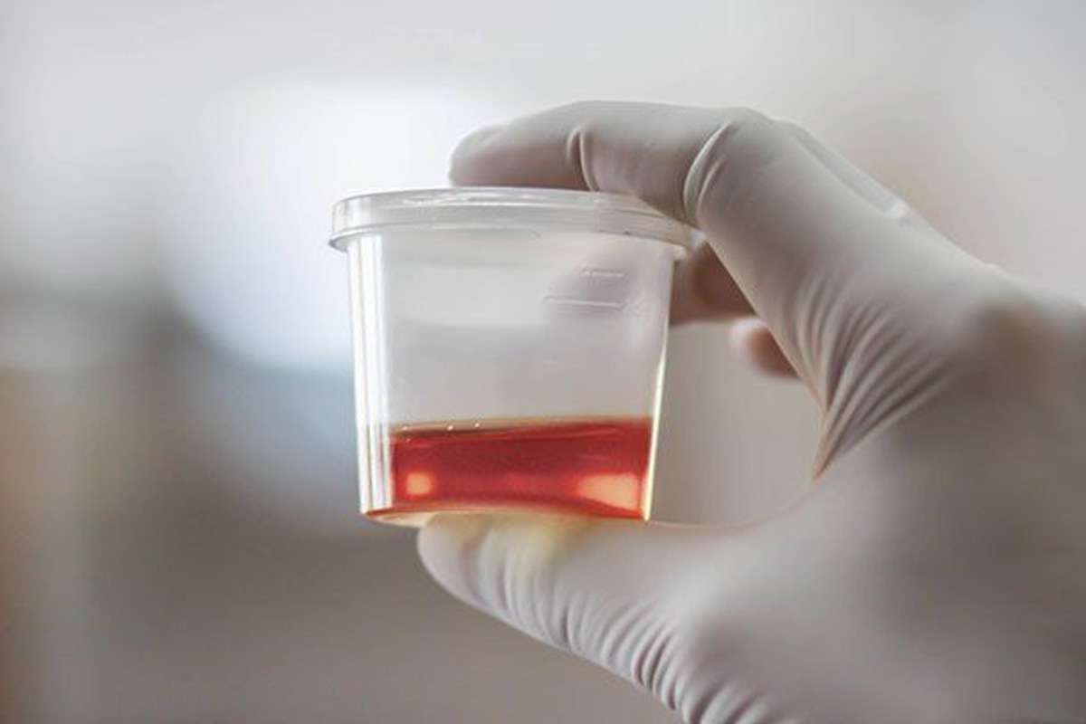 red-urine.jpg