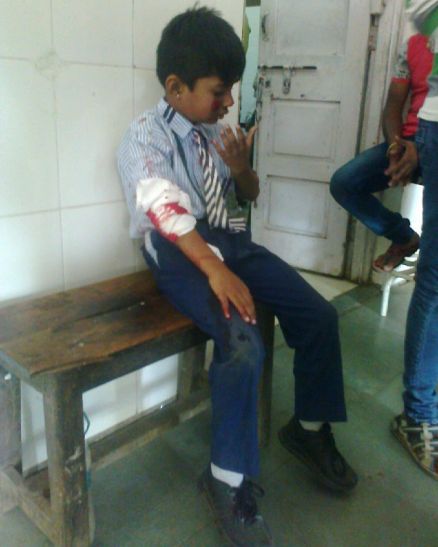 injured student सड़क पर बाइक से फिसले लापरवाह स्कूली छात्र