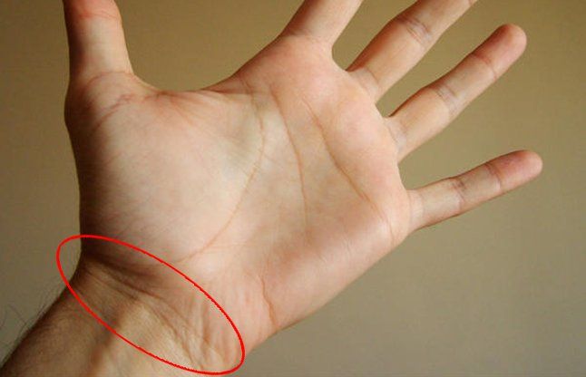 MAnibandh Lines in palmistry हाथ की इन रेखाओं से पता चलता है, कितने वर्ष जिएंगे आप