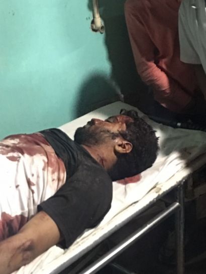 teachers murder in kashi गोलियों की गूंज से दहला मुख्यमंत्री का बनारस