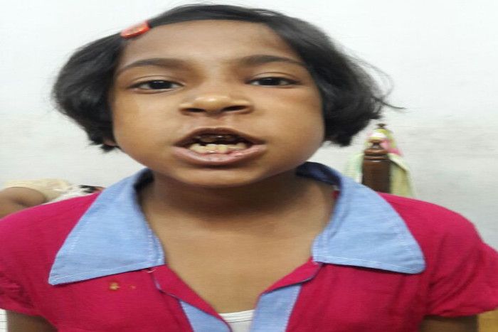 Minor injured in garden पार्क के जर्जर फिसलपट्टी से गिरकर मासूम हुई घायल