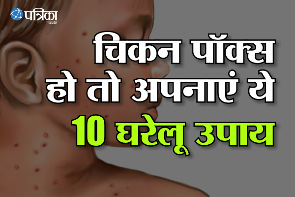 Home remedies for chicken pox क्यों होता है चिकन पॉक्स, जानिए लक्षण और घरेलू उपाय