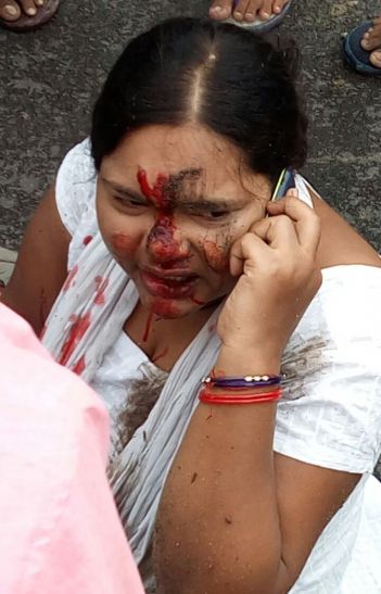 lady injured during bull anger सांड के उत्पात से हो सकता है प्रदेश में राजनीतिक उथल-पुथल