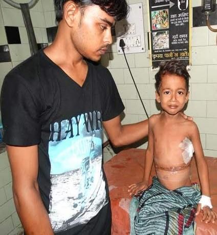 kgmu KGMU के डॉक्टरों ने बच्चे की किडनी से निकाला ढाई किलो का ट्यूमर