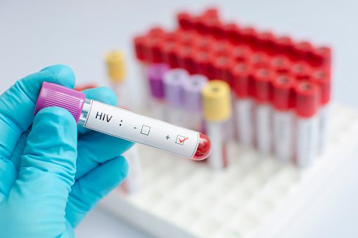 HIV positive दिमाग पर हो रहा एचआईवी पॉजिटिव होने का असर, जानिए क्यों