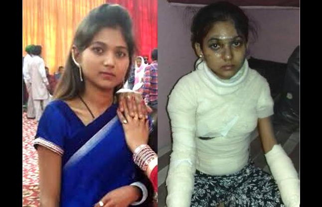 acid attack by husband before karwa chauth करवाचौथ के दिन पत्नी को तेजाब से नहलाया, 6 महीने पहले की थी लव मैरिज