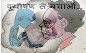 balaghat जिले में 723 बच्चे अति कुपोषित