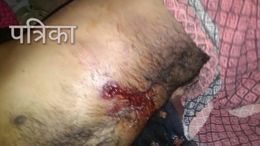 bhind मामूली विवाद में युवक को गोली मारी