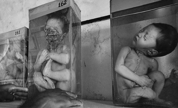 Bhopal gas tragedy,2-3 december 1984,bpl,mp #GAS TRAGEDY: लगातार होते रहे हादसे, पर भोपाल की मौत को करते रहे नजरअंदाज