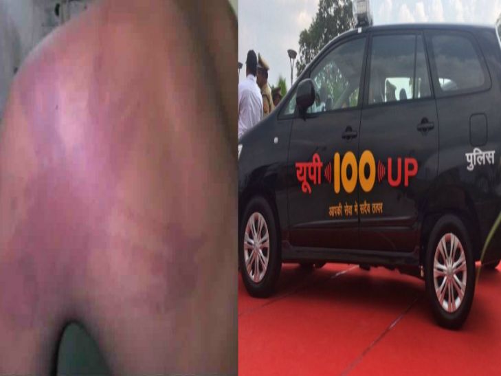 dial 100 service ये है सीएम अखिलेश की 100 नम्बर योजना, कॉल करने पर पुलिस ने युवक को बेल्ट से पीटा