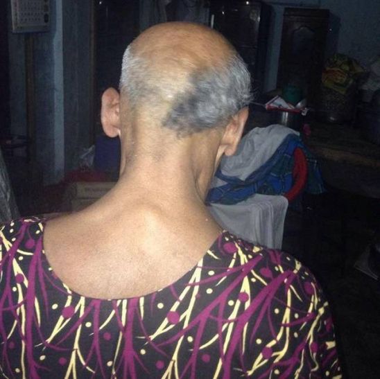 Kerala fast food vendor, 70, shaves off half head नोटबंदी: 70 साल के इस बुजुर्ग ने विरोध में 23 हजार के नोट जलाए, आधा सिर मुंडवाकर ली ये प्रतिज्ञा