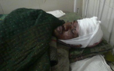 injured rural खलिहान की रखवाली कर रहे थे दंपती, खुंखार भालू आया और किया यह