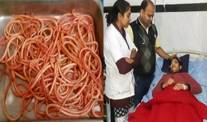 doctors find 150 live worms in womans stomach पेट के दर्द से परेशान थी यह महिला, इलाज़ के दौरान पेट से निकले 150 ज़िंदा कीड़े