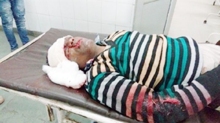 The patient suffers अस्पताल में घायल को तड़पता छोड़ा, देखने वाले गुस्साए तब किया इलाज