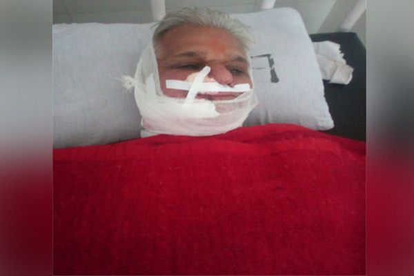 throat slit of the old man, 70 stitches वृद्ध के गले में उलझी चायना डोर, 70 टांके आए, हालत गंभीर