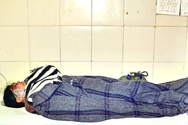 acid attack 10 माह तक पीछा 10 मिनिट पहले धमकी, एकतरफा प्यार में फेंक दिया एसिड