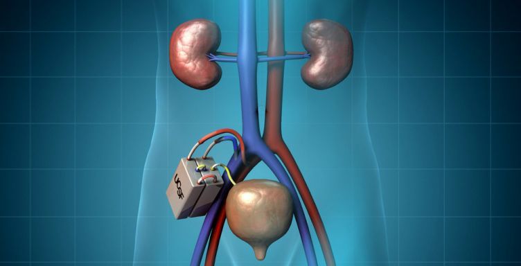 Artificial kidney 2020 तक कृत्रिम किडनी के सहारे जीने लगेगा इंसान!