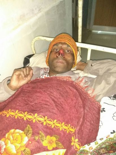 sidhi news शिक्षक की छात्रा के परिजनों ने काटी नाक