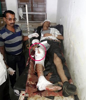 hospital कार से टक्कर से दो बाइक सवार घायल