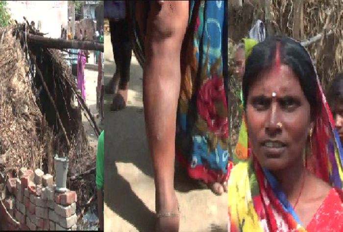 Dalit Basti Attack यूपी के बलिया में सवर्ण-दलितों के बीच हिंसा, दलितों ने कहा बीजेपी को वोट न देने पर हुई पिटाई