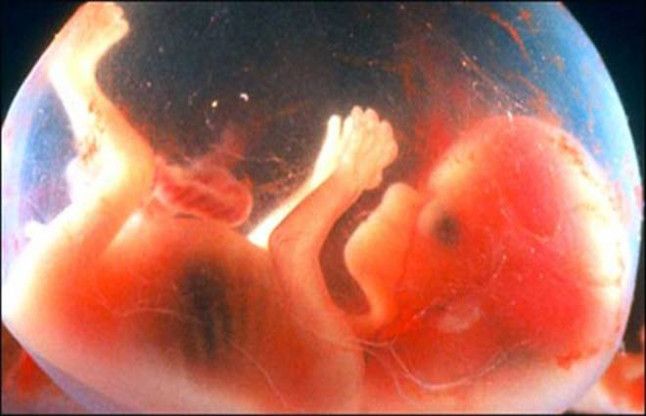 Female Foeticide गर्भ में बच्चियों के हत्यारों का पर्दाफाश