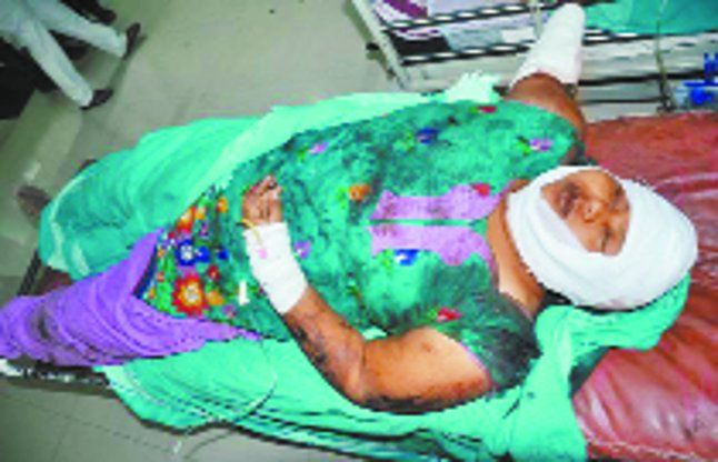 surat सौराष्ट्र एक्सप्रेस से टकराई महिला