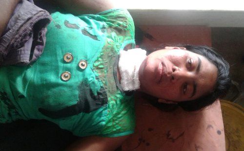 Injured girl आधी रात GF का Mobile था बिजी, सनकी BF ने बुलाया मिलने फिर किया ये हाल