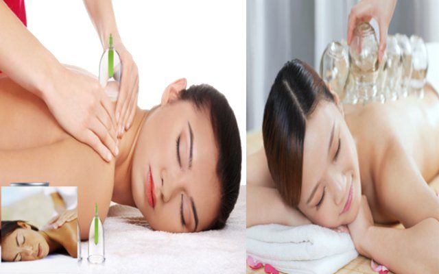 Cupping Therapy जॉइंट पेन व माइग्रेन में यूनानी कपिंग थैरेपी है कारगर