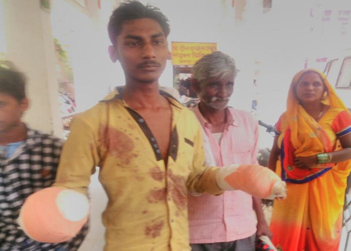 moradabad हैरतअंगेज घटना: युवक के दोनों हाथ काटे, लेकिन किसने काटे उसे भी नहीं पता