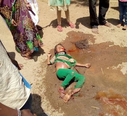 After the accident, a girl lying in a critical con पांच वर्षीय मासूम को कुचलते हुए निकल गई कार, दोनों पैर टूटे