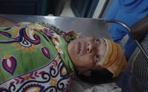 injured in hospital बेटे की तबीयत हुई खराब तो भतीजे बोले- चाची है टोनही, फिर कर दिया ये हाल