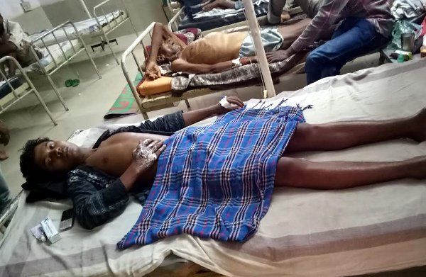 highten line Scorched 4 Children हाईटेंशन लाइन की चपेट में आए 4 बच्चे, ध्वजारोहण के लिए खड़ाकर रहे थे पाइप