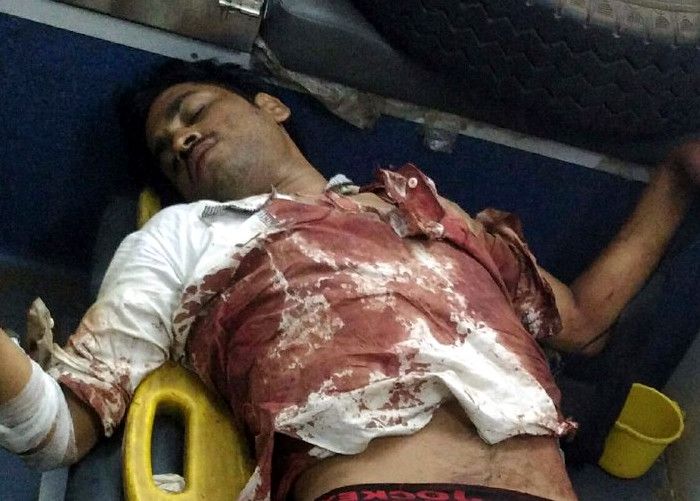 scary face of accident, legs of two pieces, road a बाइक ऐसी भिड़ी कि दो लोगों के पैर टुकड़े- टुकड़े हो गये , देखें वीडियो