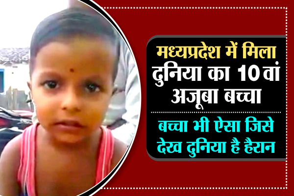 google boy google boy of india-4 मध्यप्रदेश में मिला दुनिया का 10वां अजूबा बच्चा, बच्चा भी ऐसा जिसे देख दुनिया है हैरान