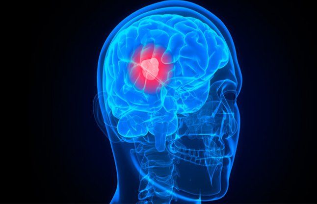 lump of the brain नाक से निकल सकती है दिमाग की गांठ