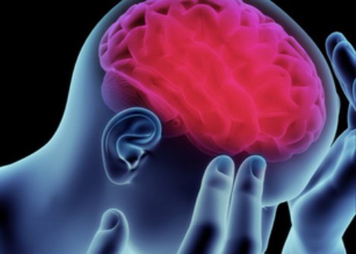 stroke-signs-you-could-be-at-risk-of-a-brain-attack