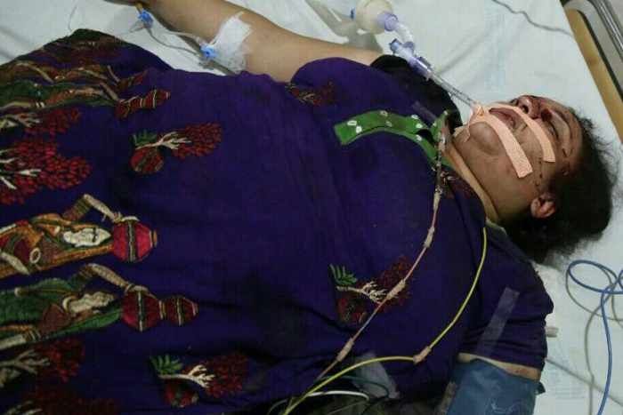 बाइकर्स ने मारा कट, स्कूटी से गिरी महिला की हालत नाजुक