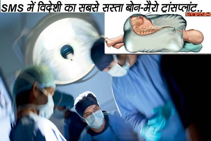 sms hospital jaipur राजस्थान के सबसे बड़े अस्पताल की दुर्लभ सफलता, अफ्रीकी मरीज का ₹ 2.5 लाख मेें बोन मैरो ट्रांसप्लांट