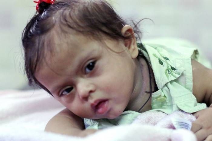 cerebral palsy treatment in homeopathy क वल ह म य प थ स स भव ह बच च म ह न व ल इस खतरन क ब म र क इल ज patrika news