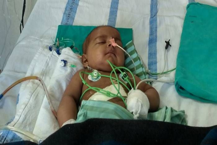 jodhpur aiims operated rare disease hepatoblastoma, hepatoblastoma patient in jodhpur, hepatoblastoma operation in jodhpur AIIMS, jodhpur AIIMS, medical news, jodhpur news एक अरब बच्चों में से राहुल को थी ये दुर्लभ बीमारी, एम्स जोधपुर के डॉक्टर्स ने 4 घंटे में दिखाया कमाल