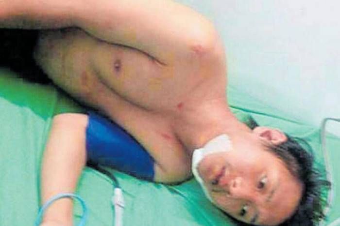 मकान मालिक ने नार्थ ईस्ट छात्र को मार-मार कर किया अधमरा, जूते भी चटवाए!
