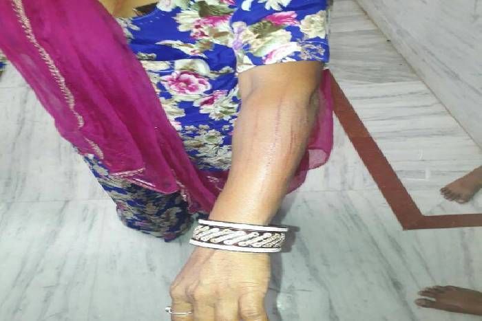jodhpur news, crime news, hindi news
युवक आए और बोले सरपंच साहब कहां, फिर पत्नी पर चला दिए चाकू