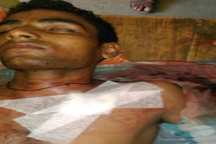 Youth injured, fired in chest firing by native cloak firing देशी कट्टे से हुई फायरिंग में युवक घायल, सीने में लगी गोली