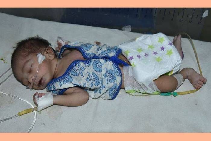 Parents found after five days जिंदा बच्चे को मृत बताने पर अस्पताल में छोड़ गए, वापस मिला तो खिल उठे चेहरे