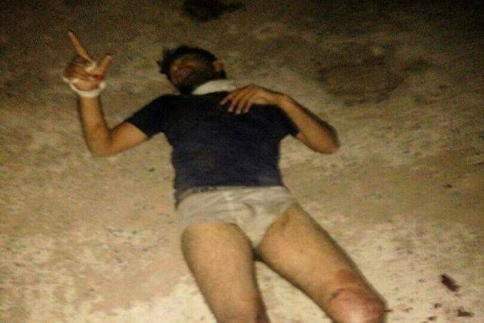 लो भाई! पकड़ा गया ये कुख्यात बदमाश, नवलगढ़ में सड़क के किनारे इस हालत में ये अपराधी