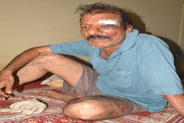 आपबीती: उन्हें लड़ता देख मैं रुक गया, फिर भी मुझे पटक-पटक कर मारा
