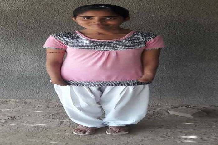 कुदरत के मजाक को दिखाया ठेंगा, प्रतिभा दिखाई तो कॉलेज ने एडमिशन से कर दिया मना