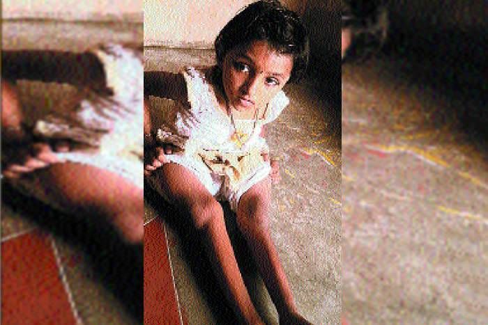 Laxmi अजीब बीमारी... 9 साल की लक्ष्मी लगती है चार साल की, 13 बार टूट चुकी हैं हड्डियां